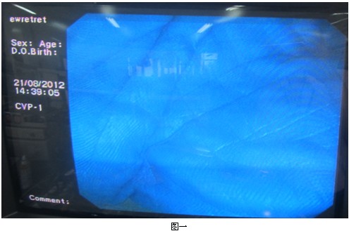 1546999773314281.jpg 不喜歡1.jpg