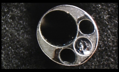 經皮椎間孔鏡治療及提斯joimaxFS63421810椎間孔鏡的維修案例